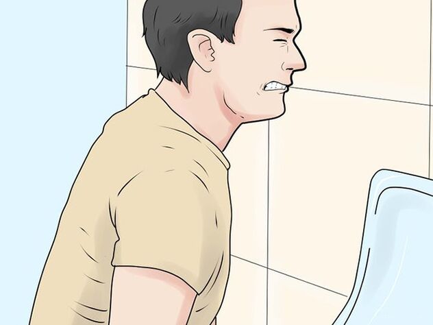 Schmerzen beim Wasserlassen aufgrund von Prostatitis